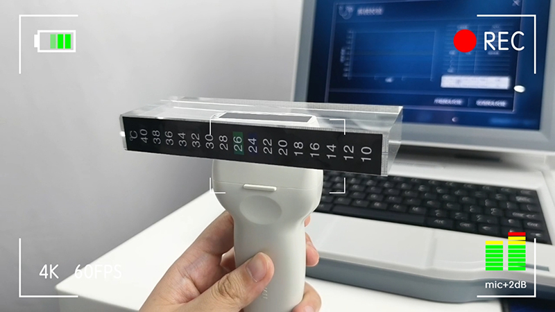如何正確維護(hù)超聲骨密度儀？骨密度儀廠家建議的養(yǎng)護(hù)規(guī)范